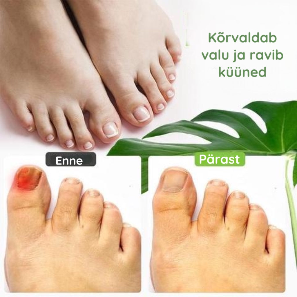 Küünte parandamise geel
