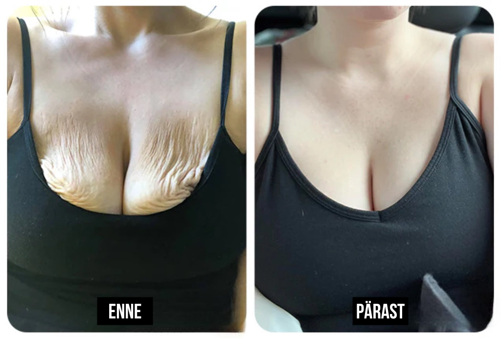 Täiustatud pinguldav ja kortse vähendav kreem