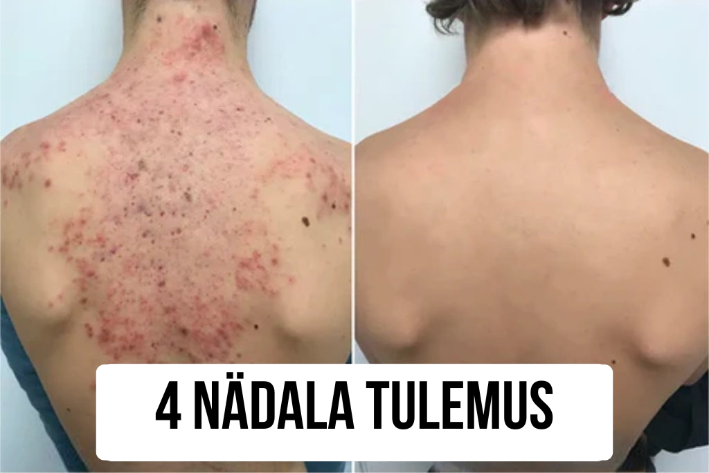 Naha taaselustav seep