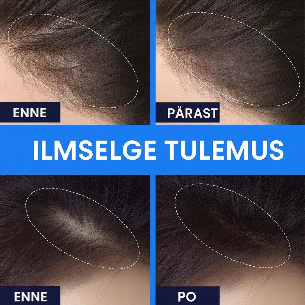 Hõrenevate juuste maskeering