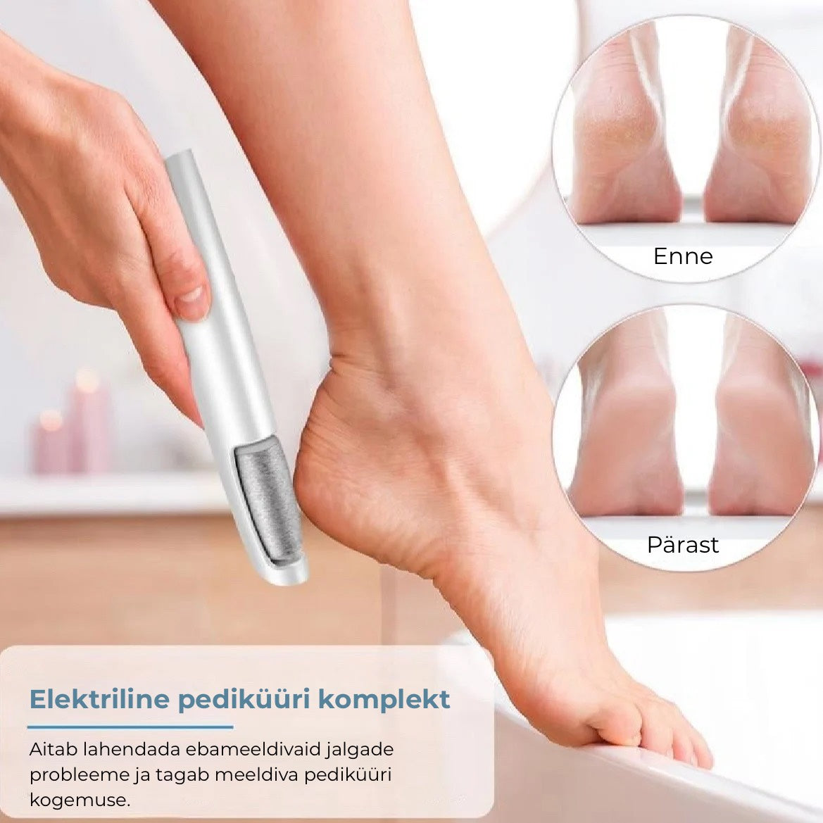 💕 Elektriline jalataldade kareduse eemaldamise seade