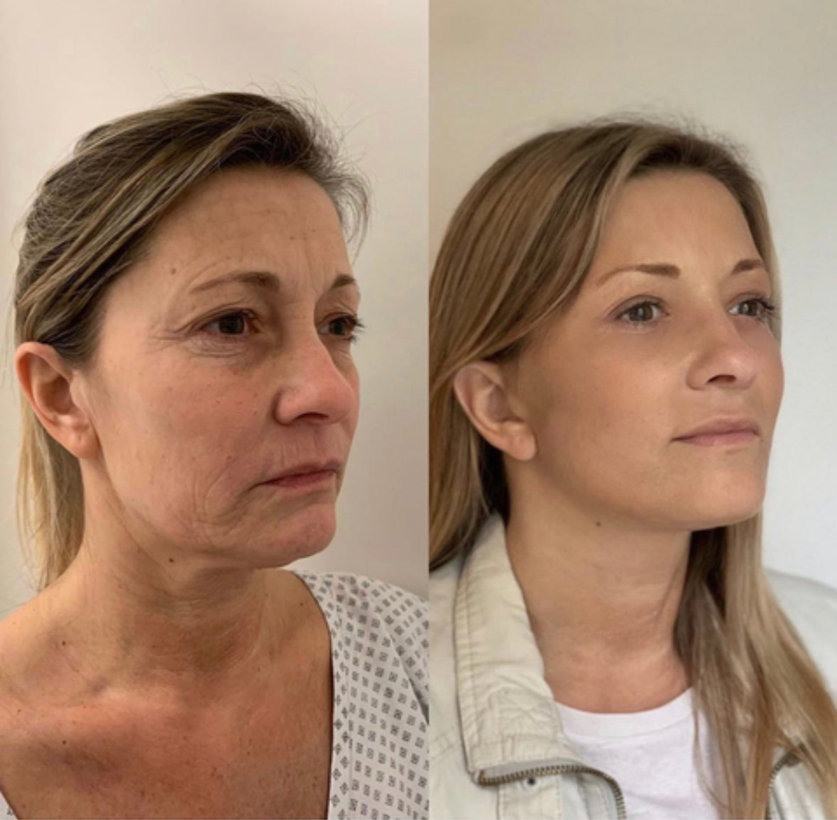 Näonaha noorendav seerum