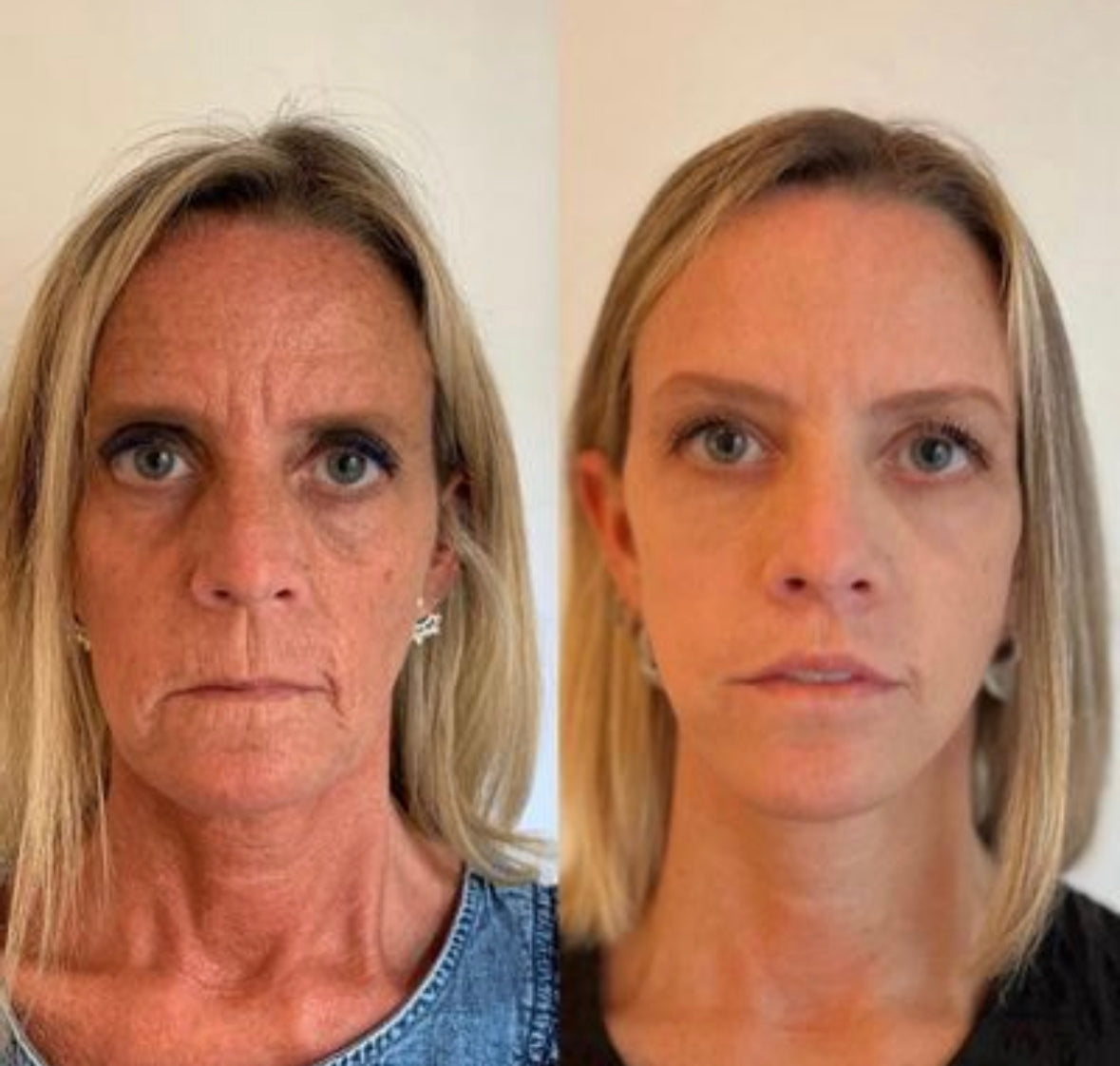 Näonaha noorendav seerum