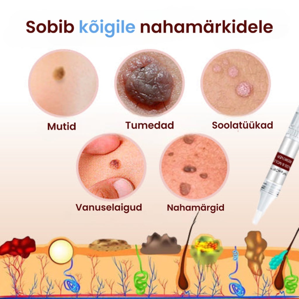 „WipeOff™ mära- ja nahamärkide eemaldamise salv