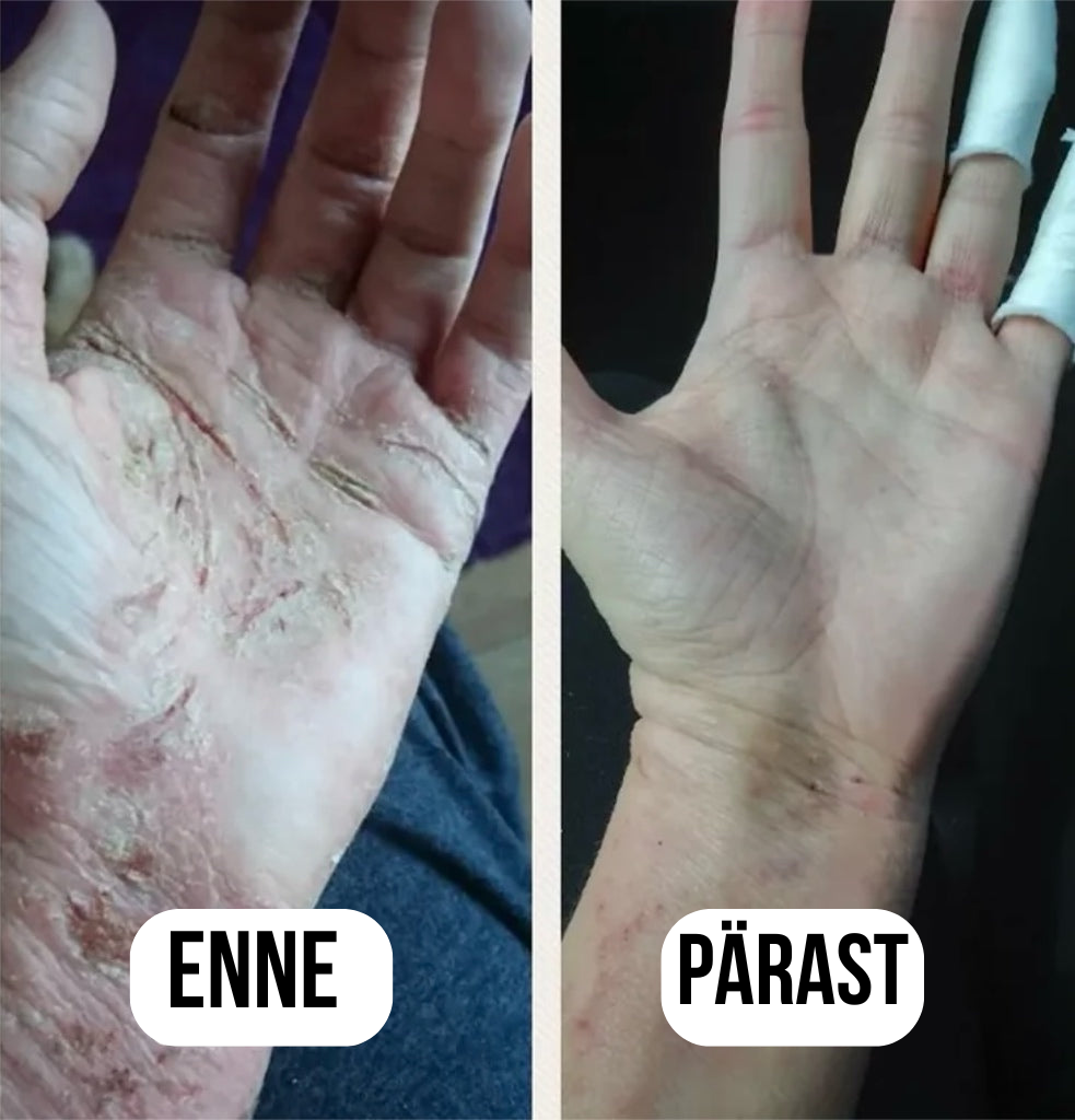 Seerum kõikidele nahaprobleemidele